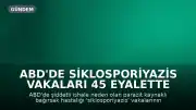 ABD'de Siklosporiyazis Vakaları 45 Eyalette 18 Bini Aştı
