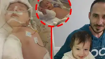 17 Günlük Asel Bebek, Özel Hastanede Yaşanan İhmal Sonucu Ciddi Yanıklarla Kurtuldu