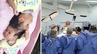 Yapışık İkizler Helena ve Heloísa Hayatını Kaybetti